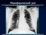 Лучевая диагностика заболеваний органов дыхания Слайд: 7
