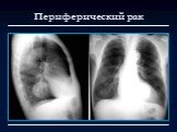 Лучевая диагностика заболеваний органов дыхания Слайд: 9