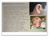 Слуховые аппараты Усиление звука слуховым аппаратом помогает людям, имеющим кондуктивную или нейросенсорную тугоухость, особенно если нарушено восприятие частот нормальной речи. Слуховые аппараты также могут помогать больным, имеющим преимущественно высокочастотную нейросенсорную тугоухость, и тем, 