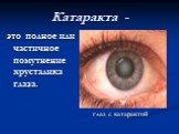 Катаракта -. это полное или частичное помутнение хрусталика глаза. глаз с катарактой
