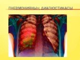 Пневмонияның диагностикасы