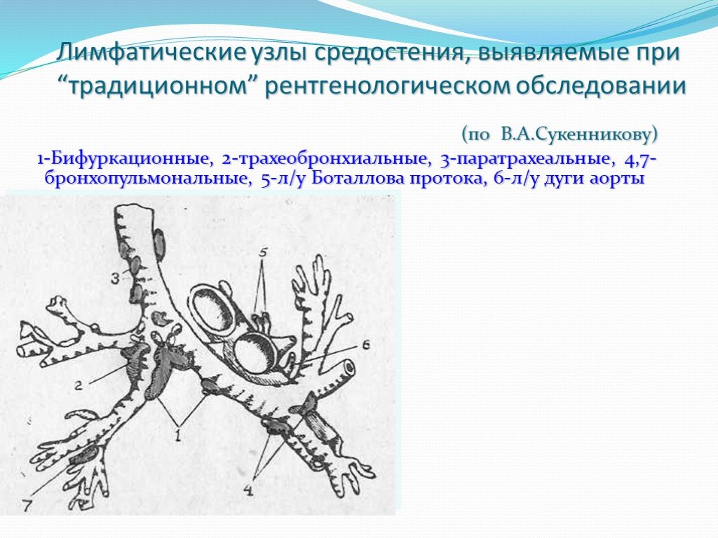 Внутригрудные лимфатические узлы