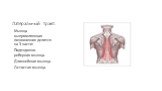 Латеральный тракт. Мышца выпрямляющая позвоночник делится на 3 части: Подвздошно-реберная мышца. Длиннейшая мышца. Остистая мышца.