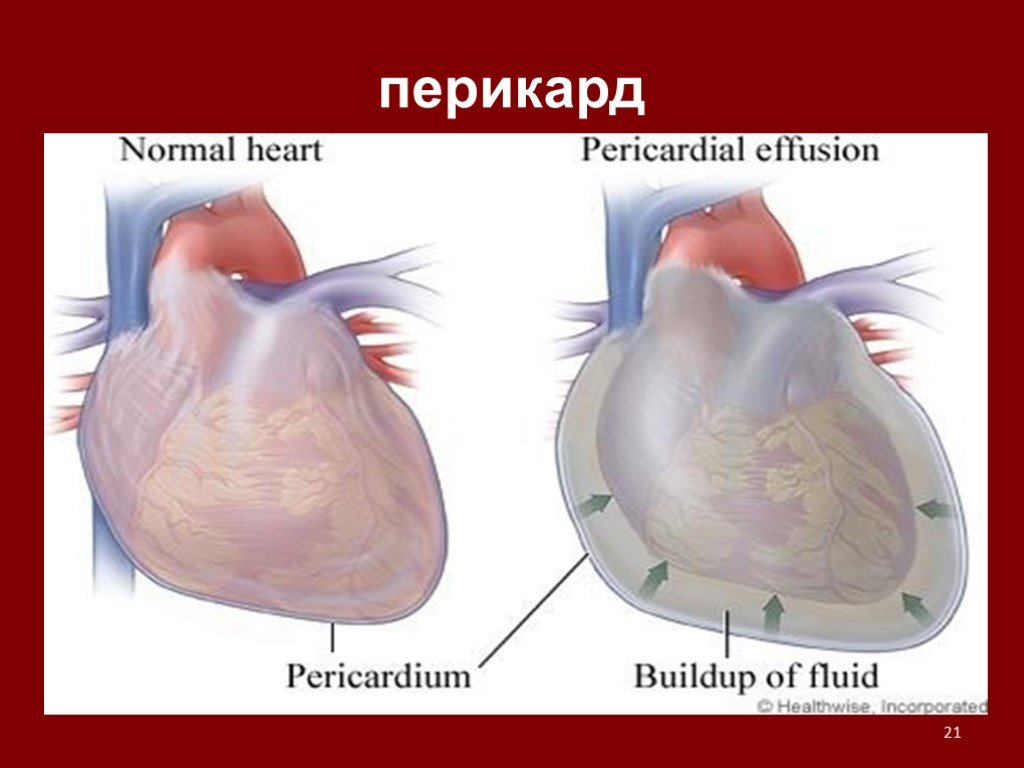 Скопление воздуха в перикарде латынь. Перикард (околосердечная сумка). Строение перикарда сердца. Сердечная сумка перикард. Сердце в перикардиальной сумке.