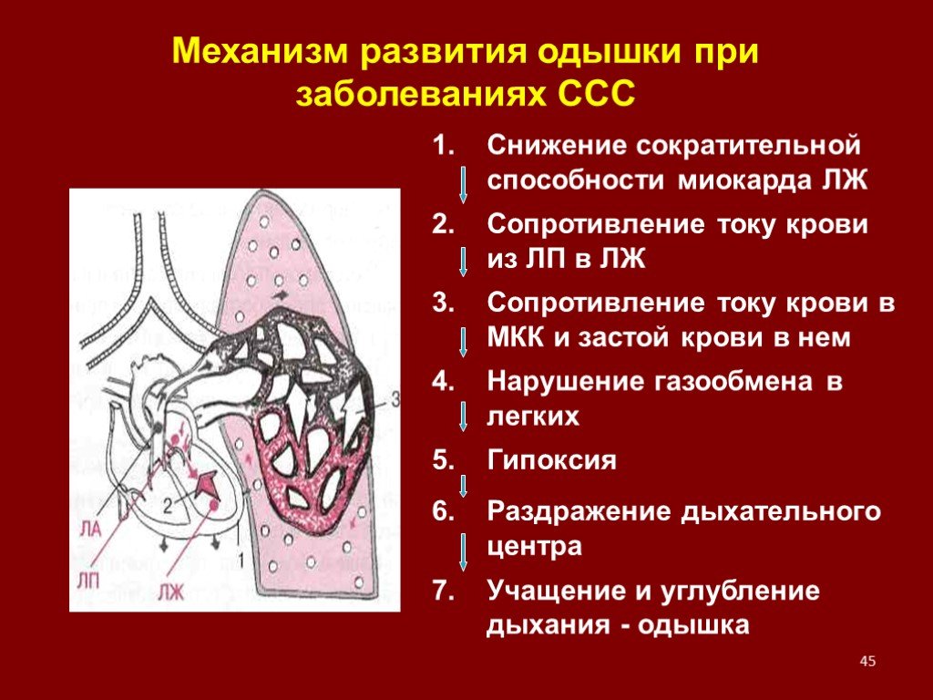 Одышка при сердечной недостаточности. Механизм развития одышки. Патогенез одышки. Механизм возникновения одышки. Механизм возникновения одышки при заболеваниях сердца.