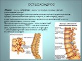 ОСТЕОХОНДРОЗ. «Osteon» - кость, «chondros» - хрящ, что иными словами означает «окостенение хряща» Термин «остеохондроз позвоночника» означает первичный дегенеративный процесс в межпозвонковых дисках, который, в свою очередь, ведет к вторичному развитию реактивных и компенсаторных изменений в костно-