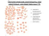 Патологические эритроциты при некоторых наследственных ГА. а - овалоциты (эллипсоциты) б – мишеневидные эритроциты в – серповидные эритроциты (дрепаноциты) г - акантоциты