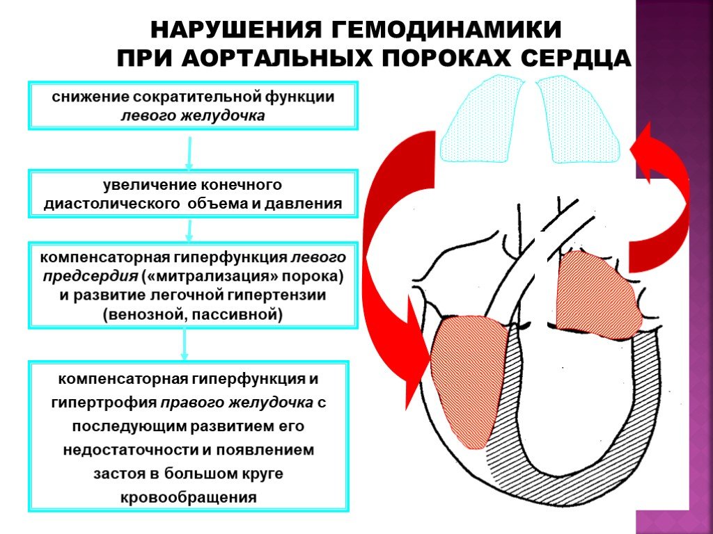 Гемодинамика пациента. Приобретенные пороки сердца изменения гемодинамики. Механизмы нарушения гемодинамики приобретенные пороки сердца. Стеноз аортального клапана. Механизм нарушения гемодинамики.. Приобретенные пороки сердца (аортальные пороки сердца.