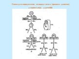 Схема для определения площади ожога (правило девяток), у взрослых(а), у детей(б)