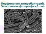 Морфология энтеробактерий. Электронная фоторгафия E. coli.