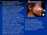 Патогенез. В основе непрофессиональной и профессиональной бронхиальной астмы лежит реагиновый тип немедленной гиперчувствительности. Аллергические цитотропные антитела присоединяются к Fc-рецепторам тканевых базофилов и после образования иммунного комплекса с аллергеном или гаптеном на поверхности м