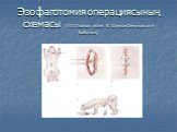 Эзофаготомия операциясының схемасы (И.П.Павлов және Е. Шумов-Симоновский бойынша)