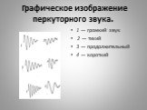 Графическое изображение перкуторного звука. 1 — громкий звук 2 — тихий 3 — продолжительный 4 — короткий