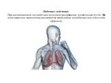 Побочные действия: При ингаляционном воздействии возможно раздражение дыхательных путей. При многократном применении развивается привыкание (ослабление или отсутствие эффекта).