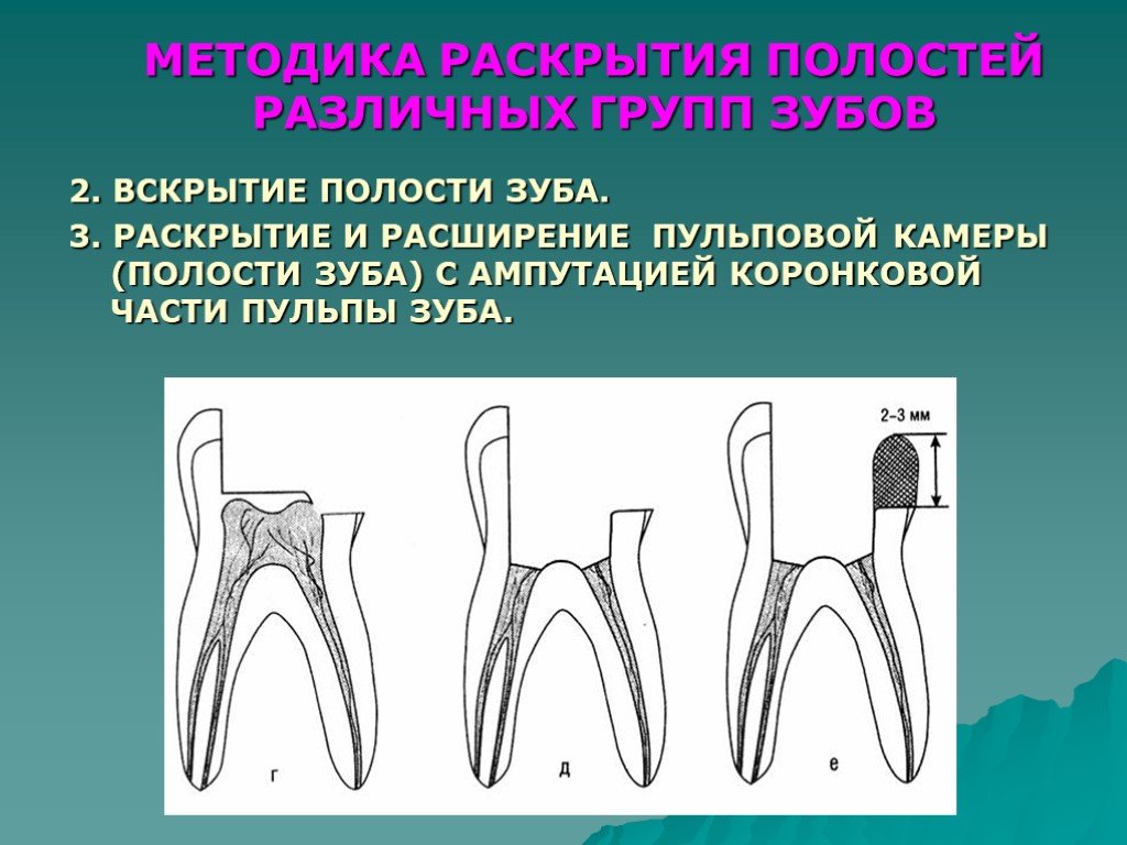 Неотложное лечение зубов с нежизнеспособной пульпой презентация