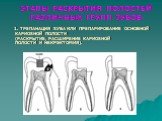 ЭТАПЫ РАСКРЫТИЯ ПОЛОСТЕЙ РАЗЛИЧНЫХ ГРУПП ЗУБОВ. 1. ТРЕПАНАЦИЯ ЗУБА ИЛИ ПРЕПАРИРОВАНИЕ ОСНОВНОЙ КАРИОЗНОЙ ПОЛОСТИ (РАСКРЫТИЕ, РАСШИРЕНИЕ КАРИОЗНОЙ ПОЛОСТИ И НЕКРЭКТОМИЯ).