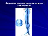Анатомия венозной системы нижних конечностей