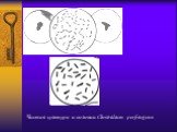 Чистая культура и колонии Clostridium perfringens