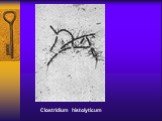 Clostridium histolyticum