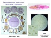 Ланцетовидный сосальщик Dicrocelium lanceatum. Яйца ланцетовидного сосальщика
