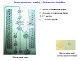 Дизентерийная амеба - Entamoeba histolitica. Жизненный цикл. 1 – малая вегетативная форма 2 – большая вегетативная форма 3, 4, 5 - цисты 6, 7 – деление цисты. Цисты кишечной амебы (непатогенной)