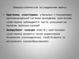 Кристаллы холестерина- у больных с поражением желчевыводящей системы выпадение кристаллов холестерина наблюдается часто- указывает на наличие желчных камней Билирубинат кальция вместе с кристаллами холестерина является также индикатором изменения коллоидальных свойств желчи (и возможного камнеобразо