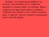 Бывает, что прилипший ребенок не рискует сам оторваться от коварной железки, а громко зовет на помощь. Ваши правильные действия помогут избежать глубоких ран. Вместо того чтобы отрывать кожу "с мясом", просто полейте прилипшее место теплой водой.