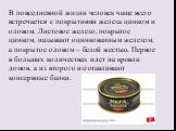 В повседневной жизни человек чаще всего встречается с покрытиями железа цинком и оловом. Листовое железо, покрытое цинком, называют оцинкованным железом, а покрытое оловом – белой жестью. Первое в больших количествах идет на кровли домов, а из второго изготавливают консервные банки.