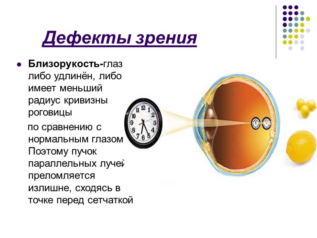 Реферат дефекты зрения как сохранить зрение