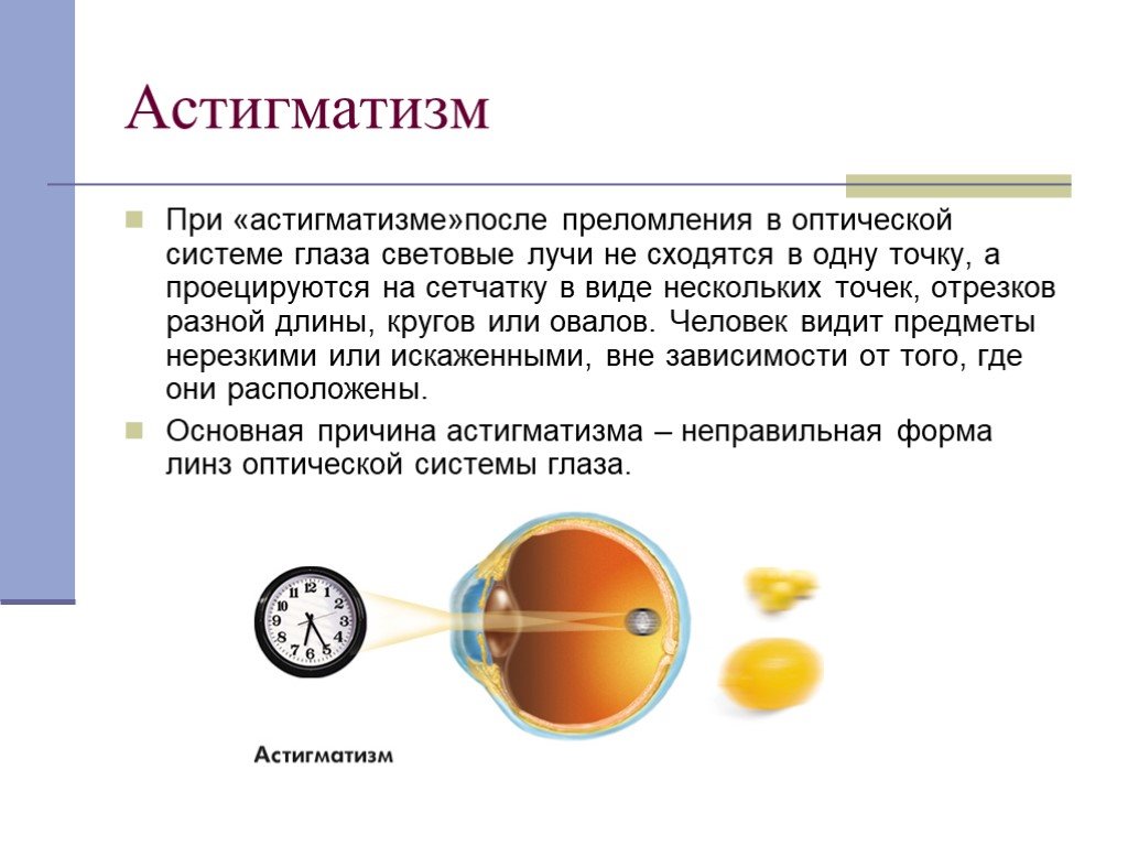 Доклад по физике на тему зрение. Астигматизм. Глаза презентация по физике. Оптическая система глаза астигматизм. При астигматизме воспринимаемый объект проецируется.
