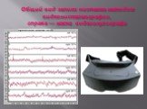 Общий вид записи нистагма методом видеонистагмографии, справа — маска видеоокулографа