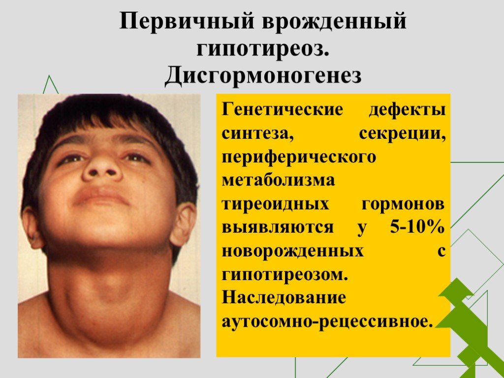 Щитовидная железа у детей 10 лет