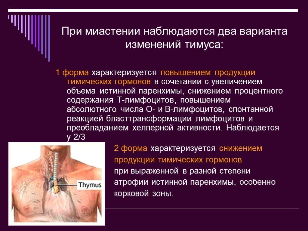 Презентация на тему тимус