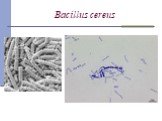 Bacillus сereus