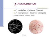 p. Fusobacterium. F. nucleatum (палочка Плаута) F. necrophorum (палочка Шморля) Ротовая полость, толстая кишка. 10 мкм