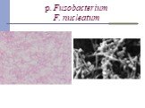p. Fusobacterium F. nucleatum