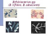 Bifidobacterium spp. (B. bifidum, B. adolescentis)