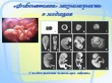 «Фибоначчиева» закономерность в медицине. Стадии развития человеческого эмбриона