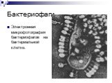 Бактериофаги. Электронная микрофотография бактериофагов на бактериальной клетке.