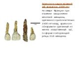 Археологи нашли вставной зуб возрастом 2300 лет На севере Франции при изучении захоронения кельтской женщины, сделанного приблизительно 2300 лет назад, археологи обнаружили сделанный из железа искусственный зуб, по форме повторяющий резцы этой женщины