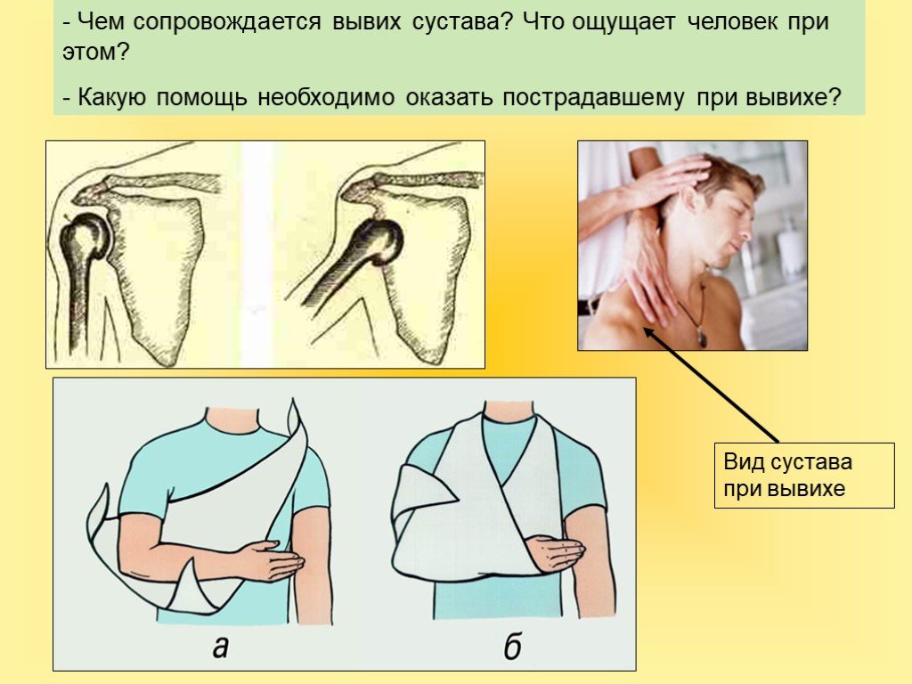 Первое вывихивающее движение при удалении. Оказание помощи при вывихе. Оказание первой помощи при вывихе плечевого сустава. ПМП при вывихе плечевого сустава. Методы оказания первой помощи при вывихе.