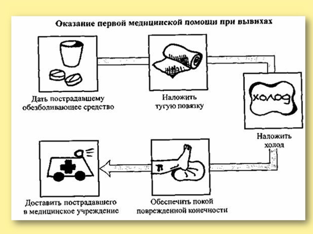 Первая помощь при вывихе сустава. При оказании первой медицинской помощи при вывихах. Алгоритм оказания первой помощи при ушибах и вывихах. Алгоритм поведения при вывихе. Алгоритм оказания первой медицинской помощи при вывихах.