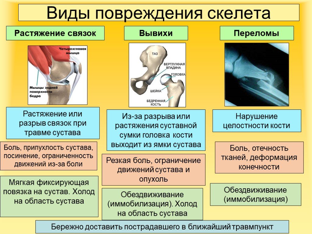 Первая помощь при травмах и ушибах презентация