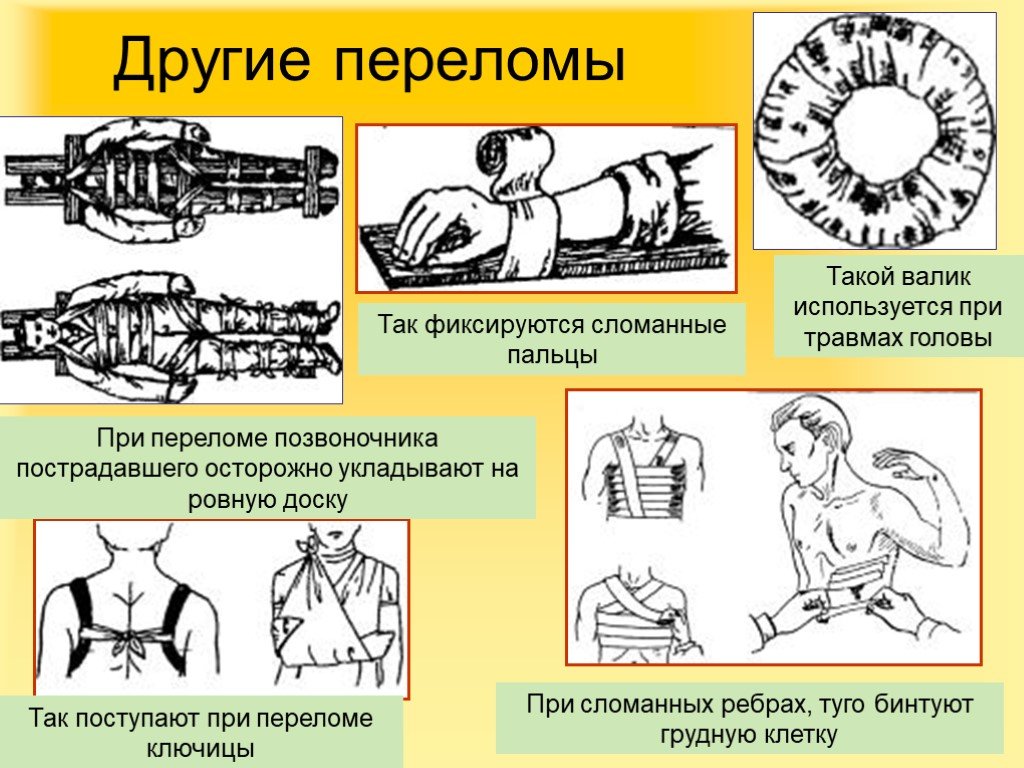 Первая помощь презентация биология 8 класс