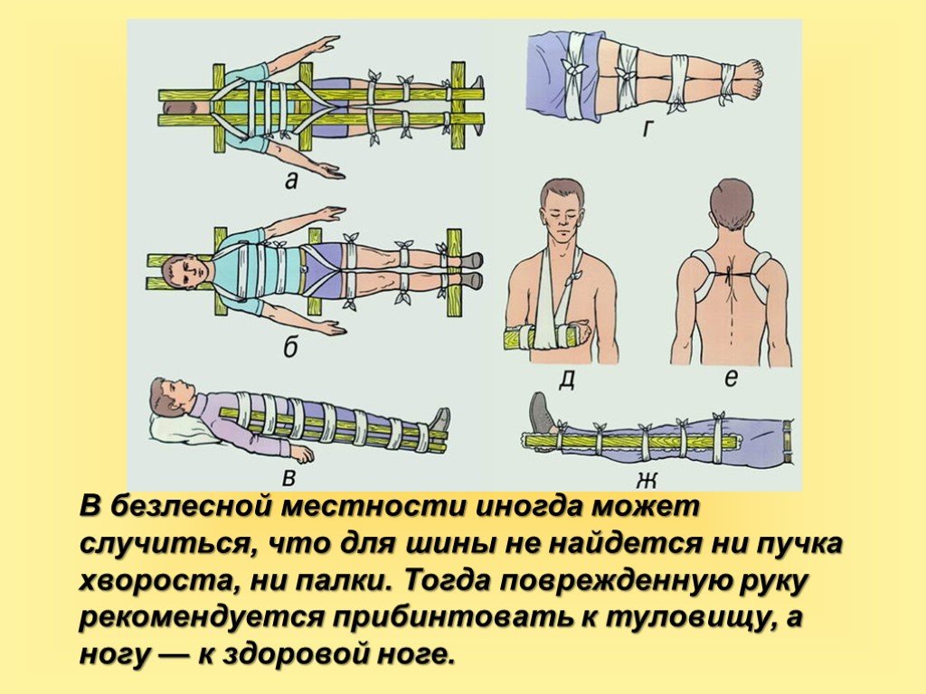 Презентация первая помощь при переломах обж 7 класс презентация