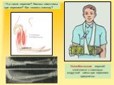 Иммобилизация верхней конечности с помощью подручной шины при переломе предплечья. - Что такое перелом? Каковы симптомы при переломе? Как оказать помощь?