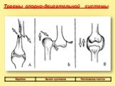 Травмы опорно-двигательной системы