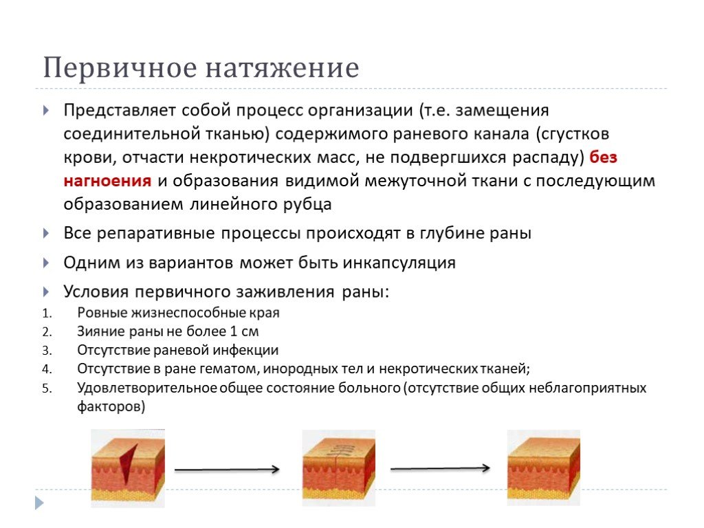 Представляет собой процедуры. Заживление РАН первичным натяжением. Заживление раны первичным и вторичным натяжением. Первичное и вторичное натяжение РАН. Рана зажила первичным натяжением.