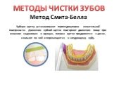 Метод Смита-Белла Зубную щетку устанавливают перпендикулярно жевательной поверхности. Движения зубной щетки повторяют движения пищи при жевании: надавливая и вращая, головка щетки продвигается к десне, скользит по ней и перемещается к следующему зубу.