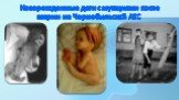 Новорожденные дети с мутациями после аварии на Чернобыльской АЭС